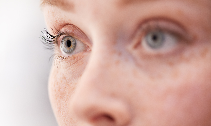 A closeup focusing on the eyes of a freckled female patient.